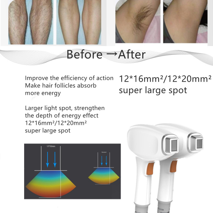 RAZORLASE® 808nm Hair Removal Machine