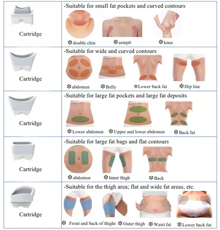 Cryolipolysis and EMSculpt Combined Machine